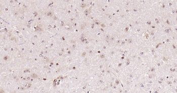 BARD1 Rabbit Polyclonal Antibody