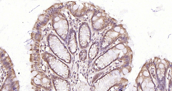 BARD1 Rabbit Polyclonal Antibody