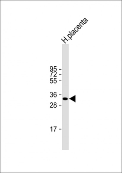 HPGD Rabbit Polyclonal Antibody