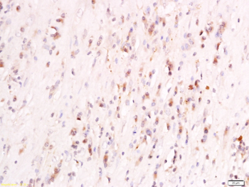 PIGR Rabbit Polyclonal Antibody