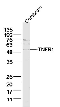 TNFR1 Rabbit Polyclonal Antibody