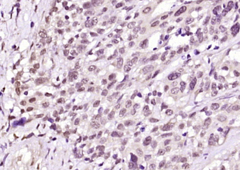 Ack1 Rabbit Polyclonal Antibody