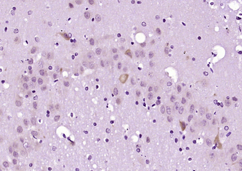 Ack1 Rabbit Polyclonal Antibody