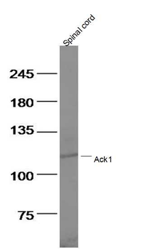Ack1 Rabbit Polyclonal Antibody