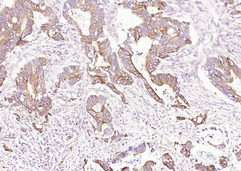 TSPAN8 Rabbit Polyclonal Antibody