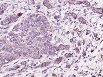 TSPAN8 Rabbit Polyclonal Antibody