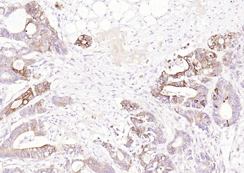 TSPAN8 Rabbit Polyclonal Antibody