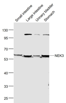 NEK3 Rabbit Polyclonal Antibody