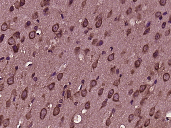 SQSTM1/P62 Rabbit Polyclonal Antibody