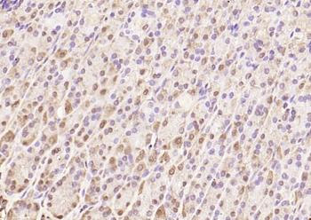 SQSTM1/P62 Rabbit Polyclonal Antibody