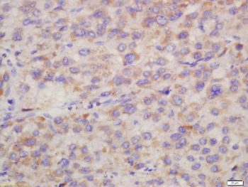 Hepsin/TMPRSS1 Rabbit Polyclonal Antibody