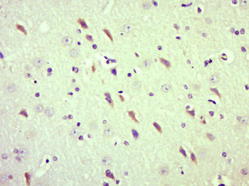 RNF45 Rabbit Polyclonal Antibody