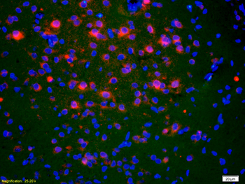 ACTH (1-39) Rabbit Polyclonal Antibody