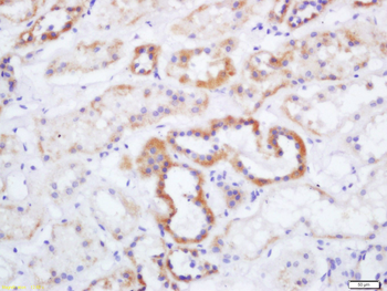 ID1 Rabbit Polyclonal Antibody