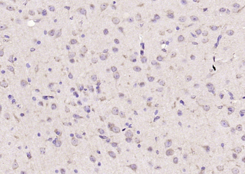 BNIP1 Rabbit Polyclonal Antibody