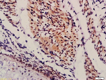 Sertad1 Rabbit Polyclonal Antibody