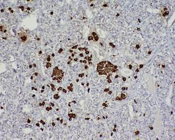 ACTH (7-23) Rabbit Polyclonal Antibody