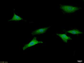 ASC/TMS1 Rabbit Polyclonal Antibody