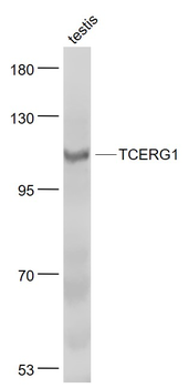 TCERG1 Rabbit Polyclonal Antibody