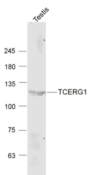 TCERG1 Rabbit Polyclonal Antibody