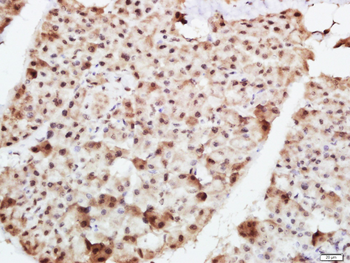 MUM1 Rabbit Polyclonal Antibody