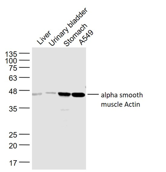 Alpha smooth muscle Actin Rabbit Polyclonal Antibody
