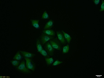 DENTT Rabbit Polyclonal Antibody