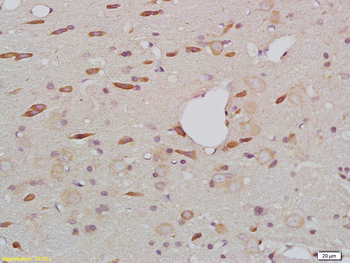 BSCL2 Rabbit Polyclonal Antibody