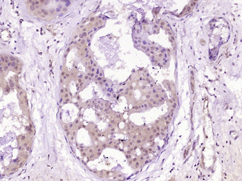Alpha Actinin 4 Rabbit Polyclonal Antibody