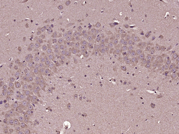 Alpha Actinin 4 Rabbit Polyclonal Antibody