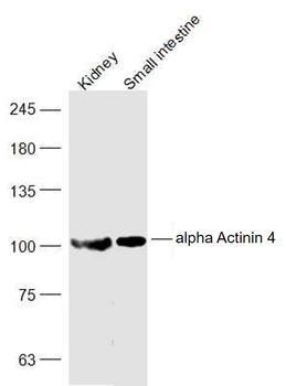 Alpha Actinin 4 Rabbit Polyclonal Antibody