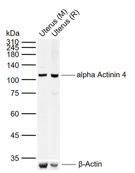 Alpha Actinin 4 Rabbit Polyclonal Antibody
