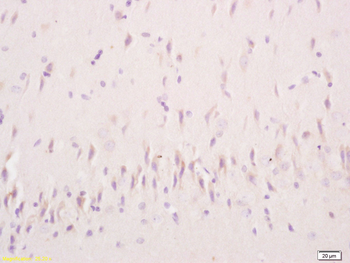 Alpha Actinin 4 Rabbit Polyclonal Antibody