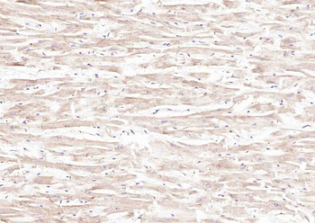 Phospho-TIRAP (Tyr86) Rabbit Polyclonal Antibody