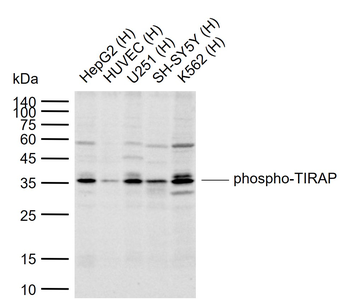 Phospho-TIRAP (Tyr86) Rabbit Polyclonal Antibody