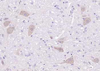 Neuronal thread protein AD7c-NTP Rabbit Polyclonal Antibody