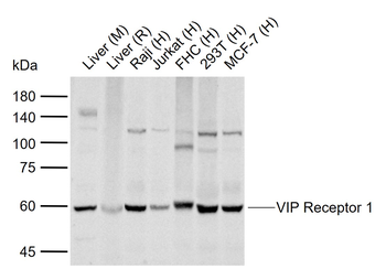 VIP Receptor 1 Rabbit Polyclonal Antibody
