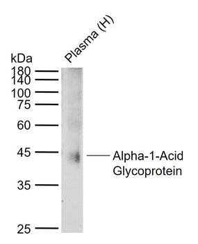 Alpha-1-Acid Glycoprotein Rabbit Polyclonal Antibody