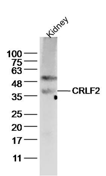 CRLF2 Rabbit Polyclonal Antibody