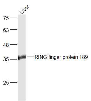 RING finger protein 189 Rabbit Polyclonal Antibody