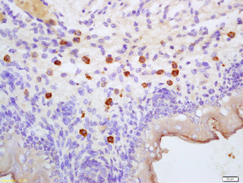 DARC Rabbit Polyclonal Antibody