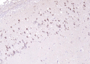 Adenylosuccinate Lyase Rabbit Polyclonal Antibody