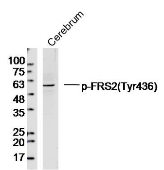 Phospho-FRS2 (Tyr436) Rabbit Polyclonal Antibody