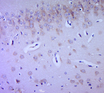 PPP2R1B Rabbit Polyclonal Antibody