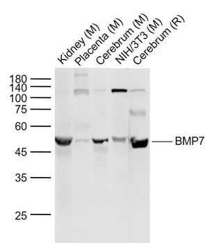 BMP7 Rabbit Polyclonal Antibody