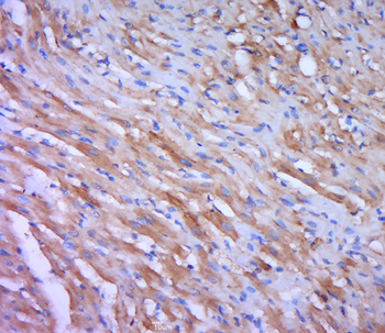 CIAP1 Rabbit Polyclonal Antibody