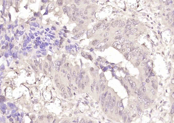 Ran Rabbit Polyclonal Antibody