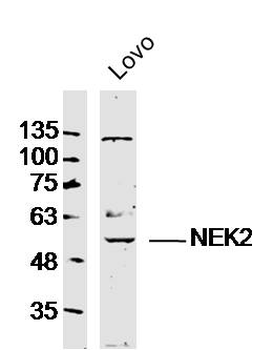 NEK2 Rabbit Polyclonal Antibody