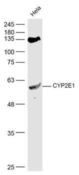 CYP2E1 Rabbit Polyclonal Antibody