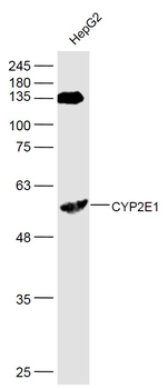 CYP2E1 Rabbit Polyclonal Antibody